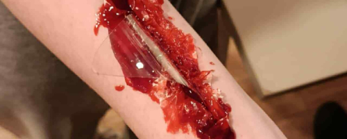 Ratuj! Nie zwlekaj! Życie ucieka!